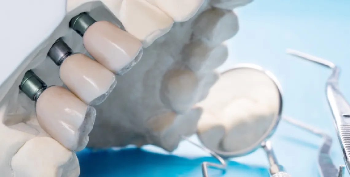 implantes-enfermedades-relacionadas