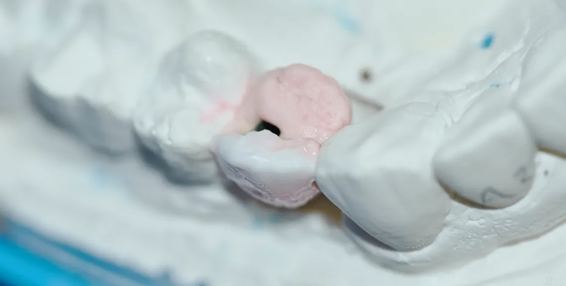 vista-dientes-desgarro